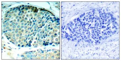 Anti-HSP27 (phospho Ser78) antibody used in IHC (Paraffin sections) (IHC-P). GTX50276
