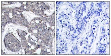 Anti-HSP27 (phospho Ser82) antibody used in IHC (Paraffin sections) (IHC-P). GTX50277