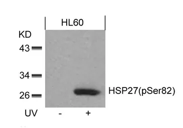 Anti-HSP27 (phospho Ser82) antibody used in Western Blot (WB). GTX50277
