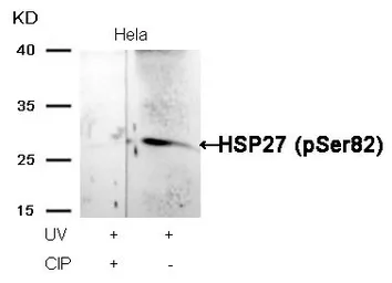 Anti-HSP27 (phospho Ser82) antibody used in Western Blot (WB). GTX50277