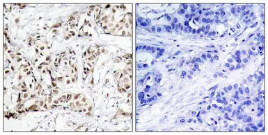 Anti-JNK (phospho Thr183) antibody used in IHC (Paraffin sections) (IHC-P). GTX50278