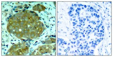 Anti-NFkB p105 (phospho Ser932) antibody used in IHC (Paraffin sections) (IHC-P). GTX50279