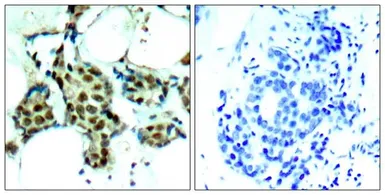 Anti-p38 MAPK (phospho Tyr182) antibody used in IHC (Paraffin sections) (IHC-P). GTX50281