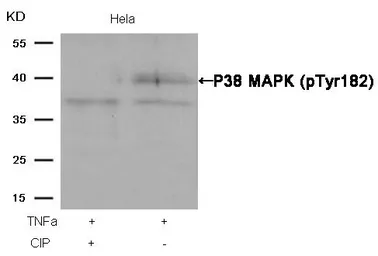 Anti-p38 MAPK (phospho Tyr182) antibody used in Western Blot (WB). GTX50281
