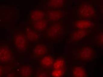 Anti-p70 S6K (phospho Thr421) antibody used in Immunocytochemistry/ Immunofluorescence (ICC/IF). GTX50282