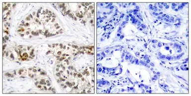 Anti-RelB (phospho Ser573) antibody used in IHC (Paraffin sections) (IHC-P). GTX50283