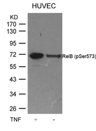 Anti-RelB (phospho Ser573) antibody used in Western Blot (WB). GTX50283