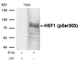 Anti-HSF1 (phospho Ser303) antibody used in Western Blot (WB). GTX50288