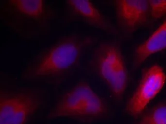 Anti-MARCKS (phospho Ser156) antibody used in Immunocytochemistry/ Immunofluorescence (ICC/IF). GTX50290