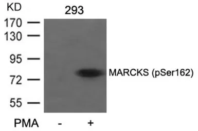 Anti-MARCKS (phospho Ser156) antibody used in Western Blot (WB). GTX50290