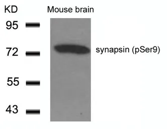 Anti-Synapsin I (phospho Ser9) antibody used in Western Blot (WB). GTX50292