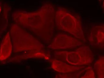 Anti-p70 S6K (phospho Ser411) antibody used in Immunocytochemistry/ Immunofluorescence (ICC/IF). GTX50294