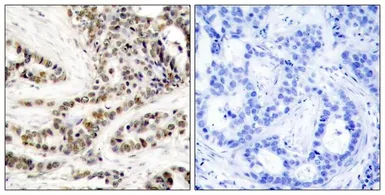 Anti-CREB (phospho Ser129) antibody used in IHC (Paraffin sections) (IHC-P). GTX50296