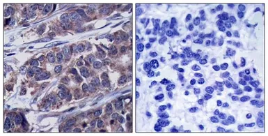 Anti-p62Dok (phospho Tyr362) antibody used in IHC (Paraffin sections) (IHC-P). GTX50297