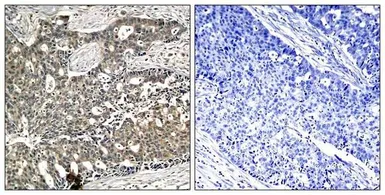 Anti-DOK2 (phospho Tyr299) antibody used in IHC (Paraffin sections) (IHC-P). GTX50299