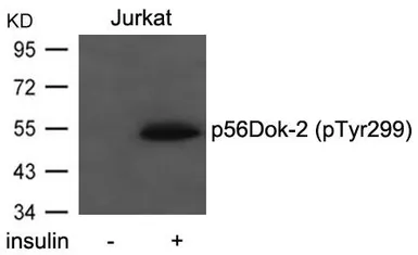Anti-DOK2 (phospho Tyr299) antibody used in Western Blot (WB). GTX50299