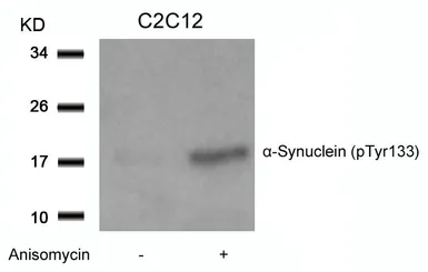 Anti-alpha Synuclein (phospho Tyr133) antibody used in Western Blot (WB). GTX50305