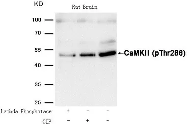 Anti-CaMKII alpha (phospho Thr286) antibody used in Western Blot (WB). GTX50307