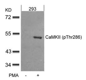 Anti-CaMKII alpha (phospho Thr286) antibody used in Western Blot (WB). GTX50307