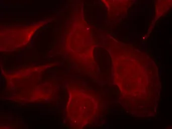 Anti-Bim (phospho Ser69) antibody used in Immunocytochemistry/ Immunofluorescence (ICC/IF). GTX50308