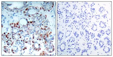 Anti-Bim (phospho Ser69) antibody used in IHC (Paraffin sections) (IHC-P). GTX50308