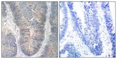 Anti-PKR (phospho Thr451) antibody used in IHC (Paraffin sections) (IHC-P). GTX50309