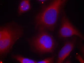Anti-MARCKS (phospho Ser152) antibody used in Immunocytochemistry/ Immunofluorescence (ICC/IF). GTX50312