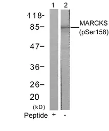 Anti-MARCKS (phospho Ser152) antibody used in Western Blot (WB). GTX50312
