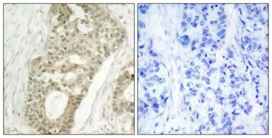 Anti-PKC delta (phospho Ser645) antibody used in IHC (Paraffin sections) (IHC-P). GTX50314