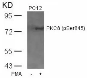 Anti-PKC delta (phospho Ser645) antibody used in Western Blot (WB). GTX50314