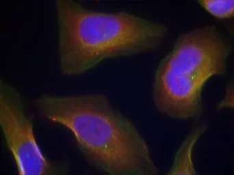 Anti-PKC theta (phospho Ser676) antibody used in Immunocytochemistry/ Immunofluorescence (ICC/IF). GTX50315