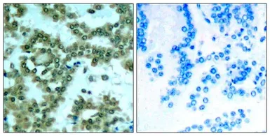 Anti-PKC theta (phospho Ser676) antibody used in IHC (Paraffin sections) (IHC-P). GTX50315