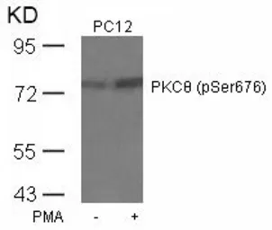 Anti-PKC theta (phospho Ser676) antibody used in Western Blot (WB). GTX50315