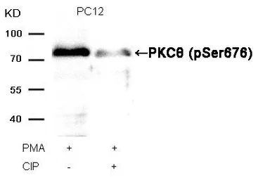 Anti-PKC theta (phospho Ser676) antibody used in Western Blot (WB). GTX50315