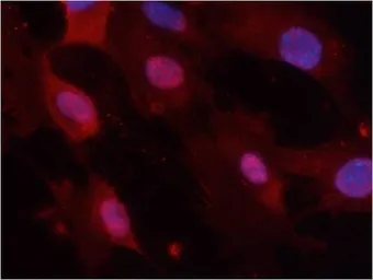 Anti-GSK3 alpha (phospho Tyr279) + GSK3 beta (phospho Tyr216) antibody used in Immunocytochemistry/ Immunofluorescence (ICC/IF). GTX50316