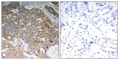 Anti-GSK3 alpha (phospho Tyr279) + GSK3 beta (phospho Tyr216) antibody used in IHC (Paraffin sections) (IHC-P). GTX50316