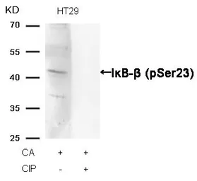 Anti-IKB beta (phospho Ser23) antibody used in Western Blot (WB). GTX50317