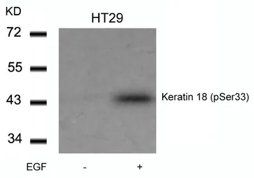 Anti-Cytokeratin 18 (phospho Ser33) antibody used in Western Blot (WB). GTX50318