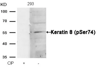 Anti-Cytokeratin 8 (phospho Ser74) antibody used in Western Blot (WB). GTX50320