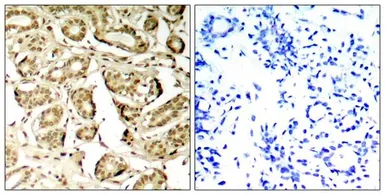 Anti-MEF2A (phospho Ser408) antibody used in IHC (Paraffin sections) (IHC-P). GTX50322