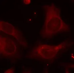 Anti-NFkB p105 (phospho Ser927) antibody used in Immunocytochemistry/ Immunofluorescence (ICC/IF). GTX50324