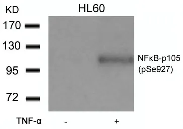 Anti-NFkB p105 (phospho Ser927) antibody used in Western Blot (WB). GTX50324