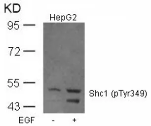Anti-SHC1 (phospho Tyr239) antibody used in Western Blot (WB). GTX50325