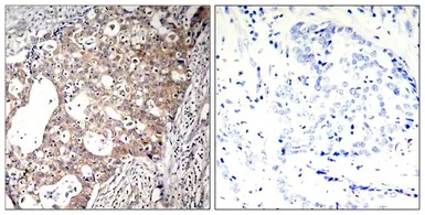 Anti-SHC1 (phospho Tyr317) antibody used in IHC (Paraffin sections) (IHC-P). GTX50326