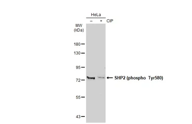 Anti-SHP2 (phospho Tyr580) antibody used in Western Blot (WB). GTX50329