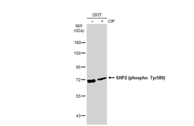 Anti-SHP2 (phospho Tyr580) antibody used in Western Blot (WB). GTX50329