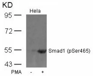 Anti-Smad1 (phospho Ser465) antibody used in Western Blot (WB). GTX50330