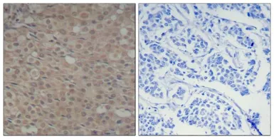 Anti-SMAD3 (phospho Ser425) antibody used in IHC (Paraffin sections) (IHC-P). GTX50333
