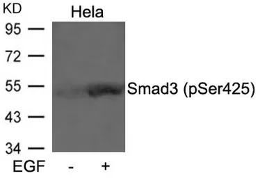 Anti-SMAD3 (phospho Ser425) antibody used in Western Blot (WB). GTX50333