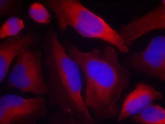 Anti-Tyrosine Hydroxylase (phospho Ser19) antibody used in Immunocytochemistry/ Immunofluorescence (ICC/IF). GTX50337